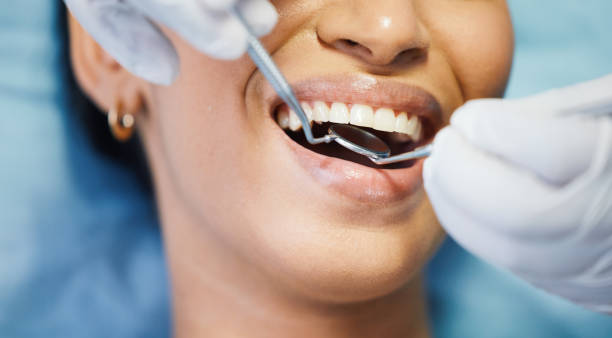Best Emergency Broken Tooth Repair in La Mesa, CA